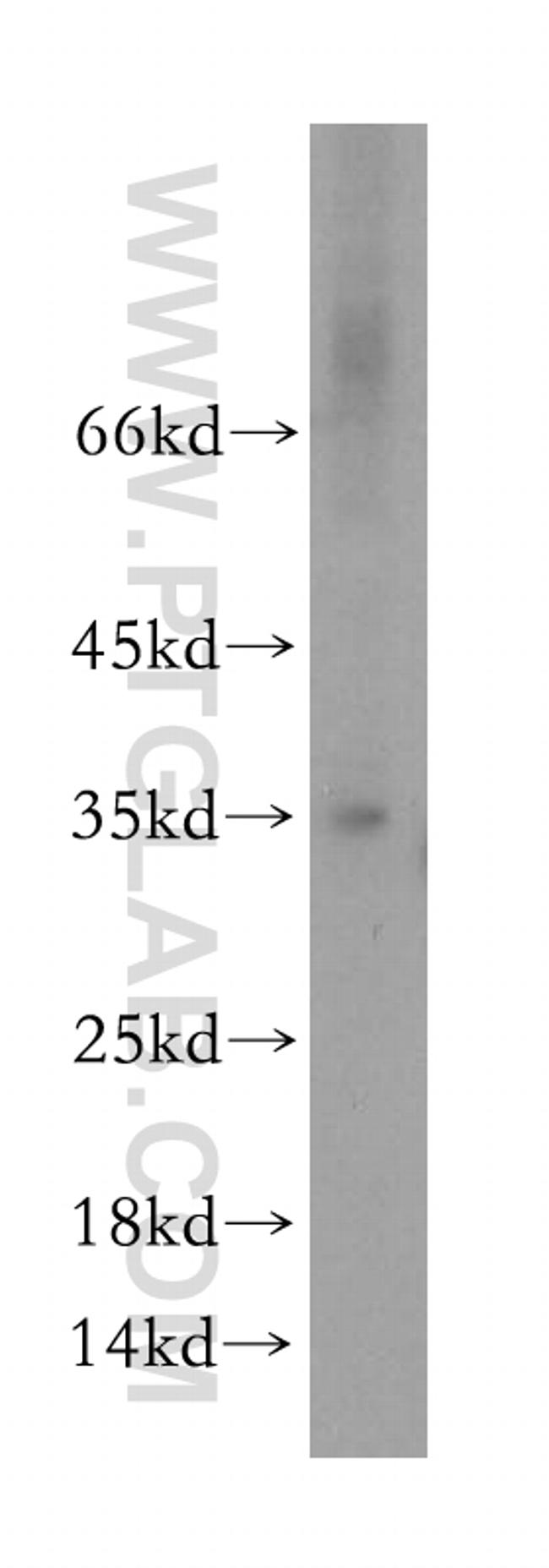 HMGCL Antibody in Western Blot (WB)