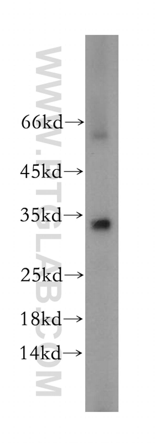 HMGCL Antibody in Western Blot (WB)