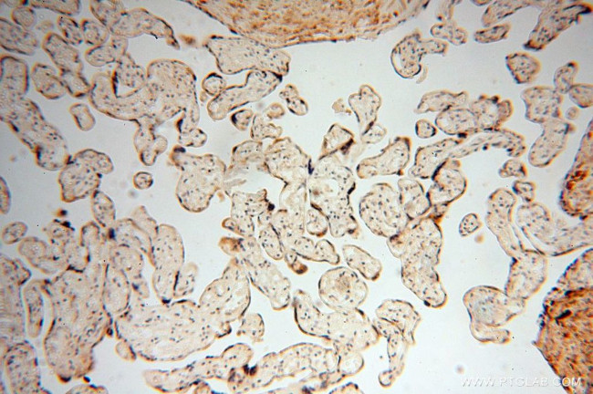 GALNTL2 Antibody in Immunohistochemistry (Paraffin) (IHC (P))