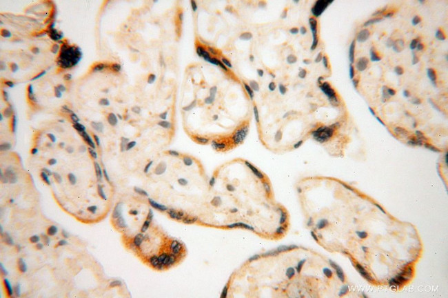 GALNTL2 Antibody in Immunohistochemistry (Paraffin) (IHC (P))