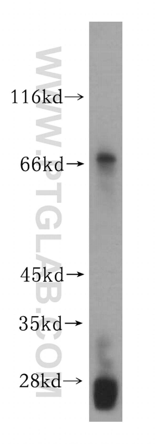 GALNTL2 Antibody in Western Blot (WB)