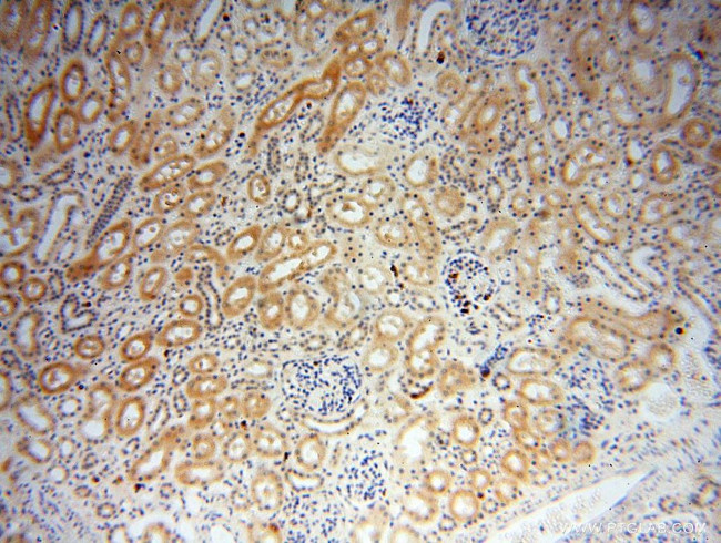 GALNTL2 Antibody in Immunohistochemistry (Paraffin) (IHC (P))