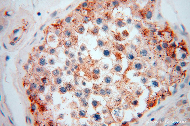 GALNTL2 Antibody in Immunohistochemistry (Paraffin) (IHC (P))