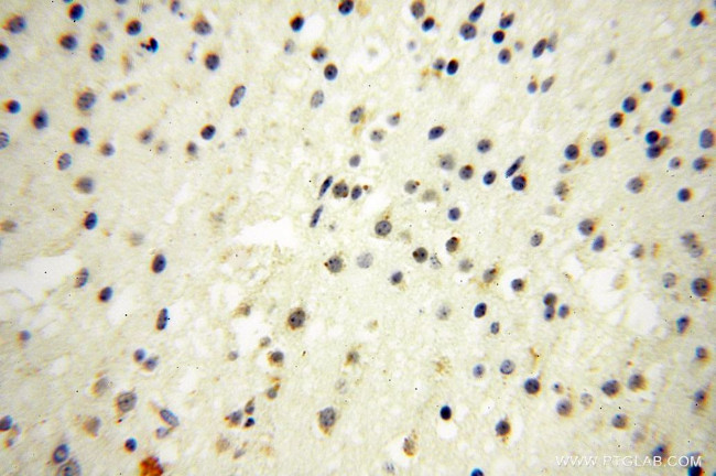 GALNTL2 Antibody in Immunohistochemistry (Paraffin) (IHC (P))