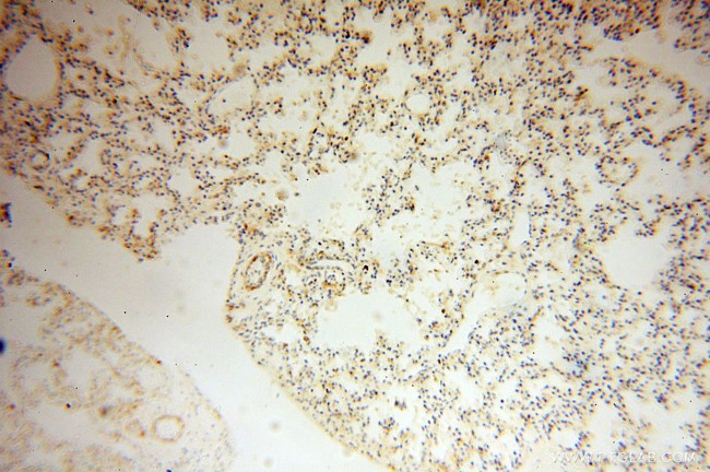 GALNTL2 Antibody in Immunohistochemistry (Paraffin) (IHC (P))