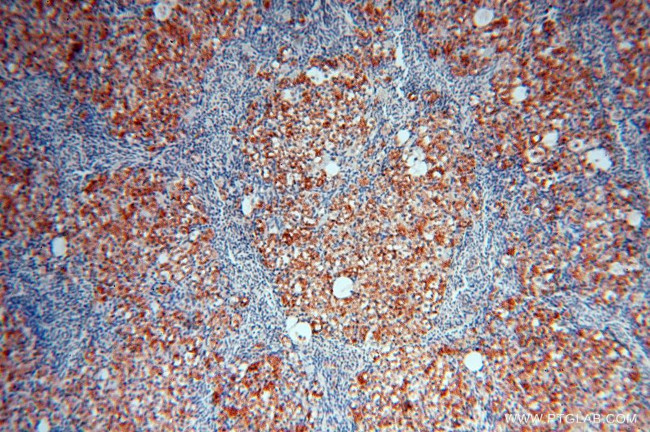 GALNTL2 Antibody in Immunohistochemistry (Paraffin) (IHC (P))