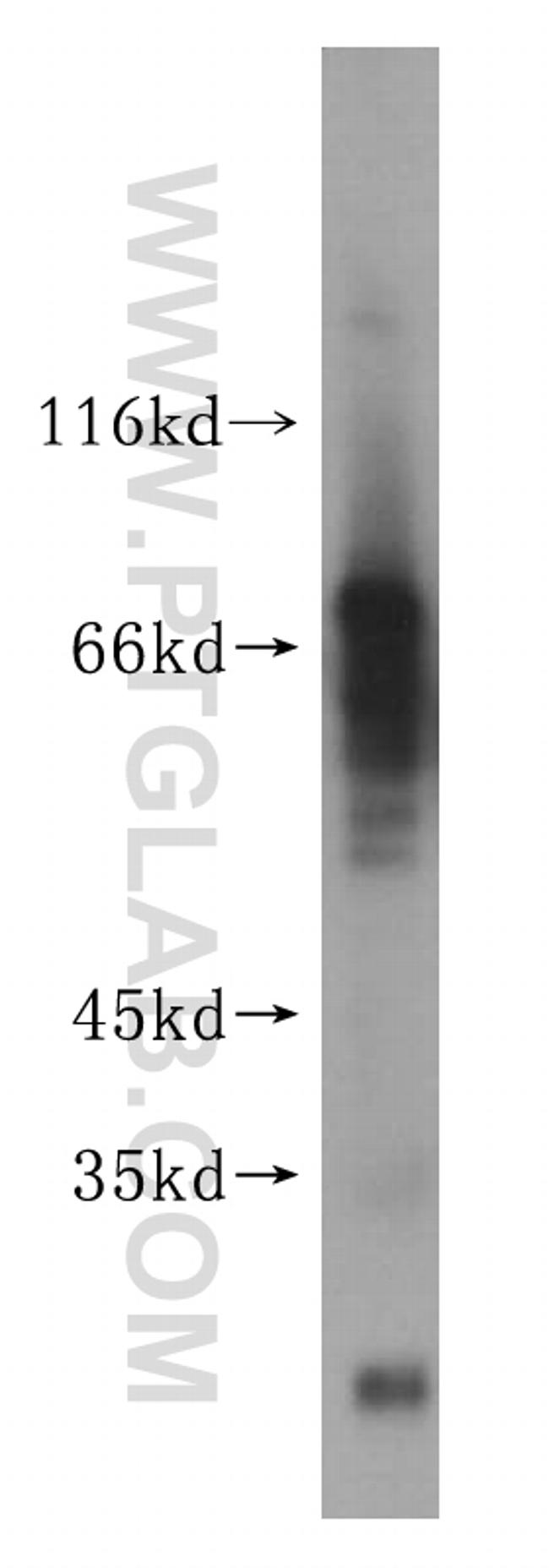 GALNTL2 Antibody in Western Blot (WB)
