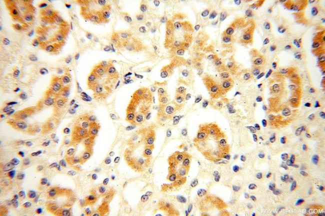 NDUFB1 Antibody in Immunohistochemistry (Paraffin) (IHC (P))