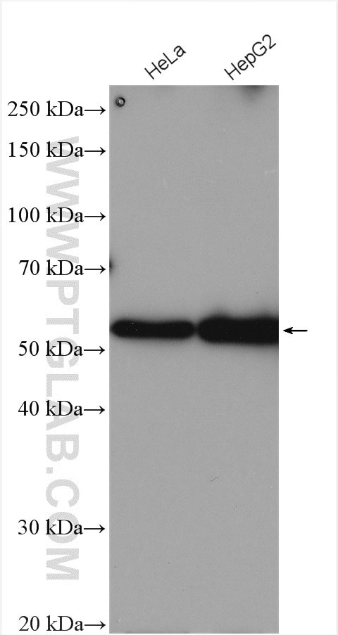 UBR7 Antibody in Western Blot (WB)