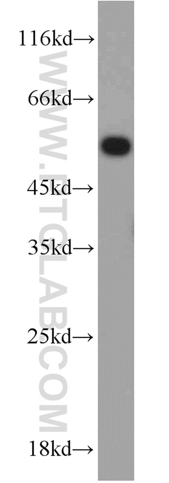 UBR7 Antibody in Western Blot (WB)