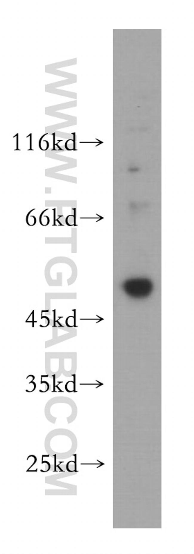 UBR7 Antibody in Western Blot (WB)