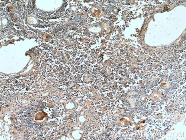 UNC13D/Munc13-4 Antibody in Immunohistochemistry (Paraffin) (IHC (P))