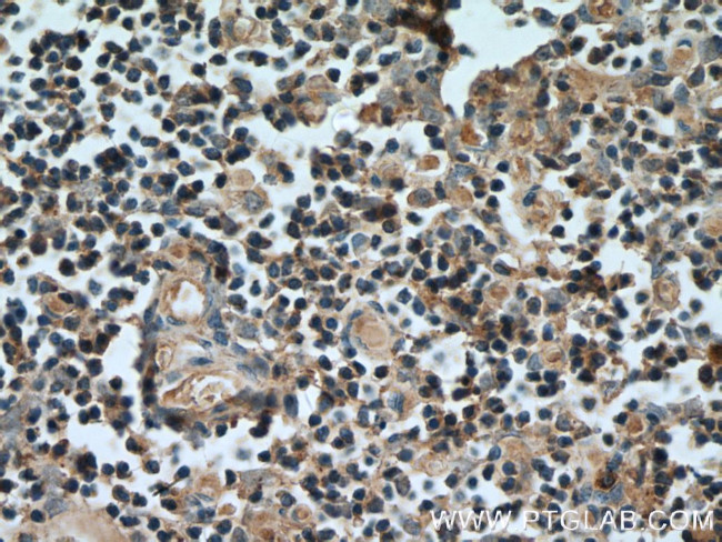 UNC13D/Munc13-4 Antibody in Immunohistochemistry (Paraffin) (IHC (P))