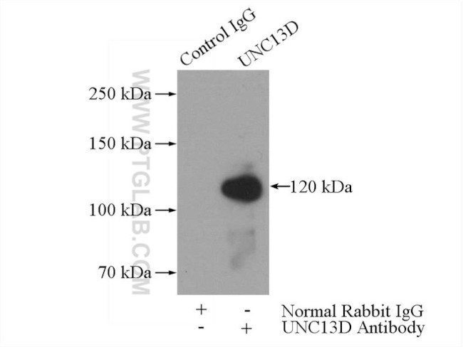 UNC13D/Munc13-4 Antibody in Immunoprecipitation (IP)