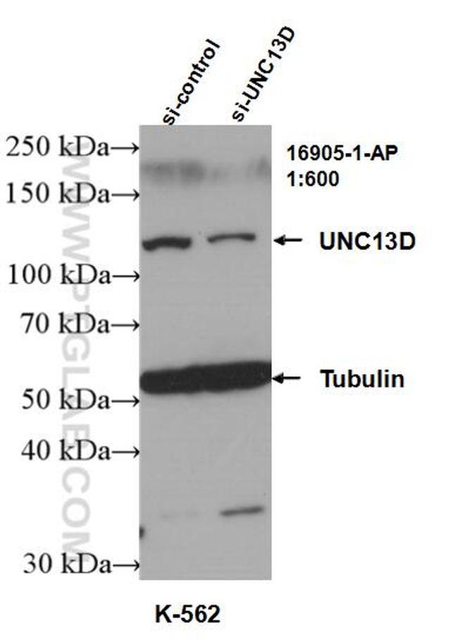 UNC13D/Munc13-4 Antibody in Western Blot (WB)