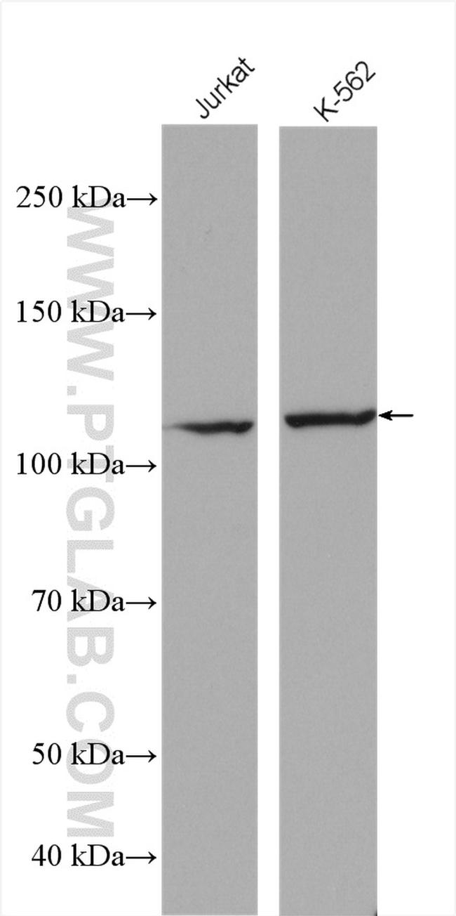 UNC13D/Munc13-4 Antibody in Western Blot (WB)