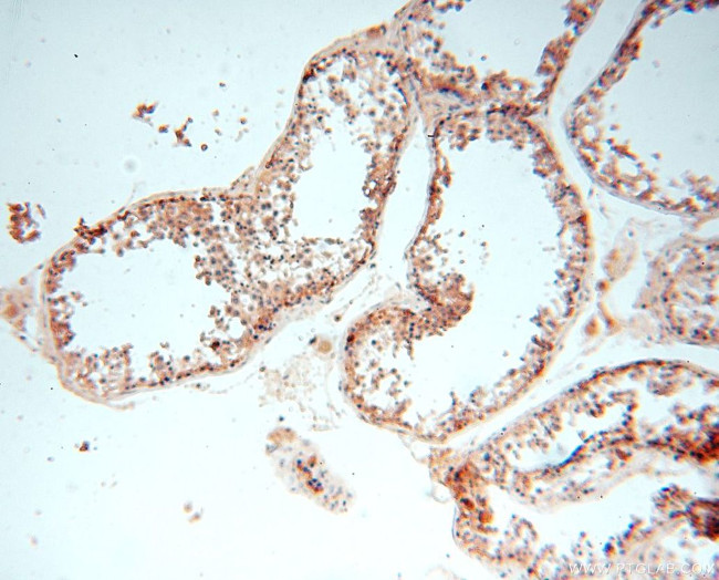 UNC13D/Munc13-4 Antibody in Immunohistochemistry (Paraffin) (IHC (P))