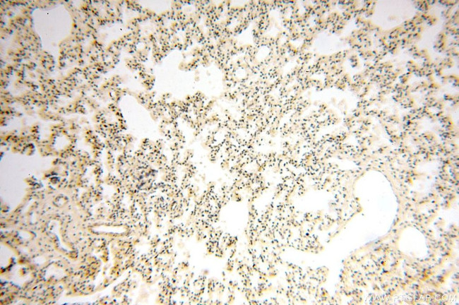 UNC13D/Munc13-4 Antibody in Immunohistochemistry (Paraffin) (IHC (P))