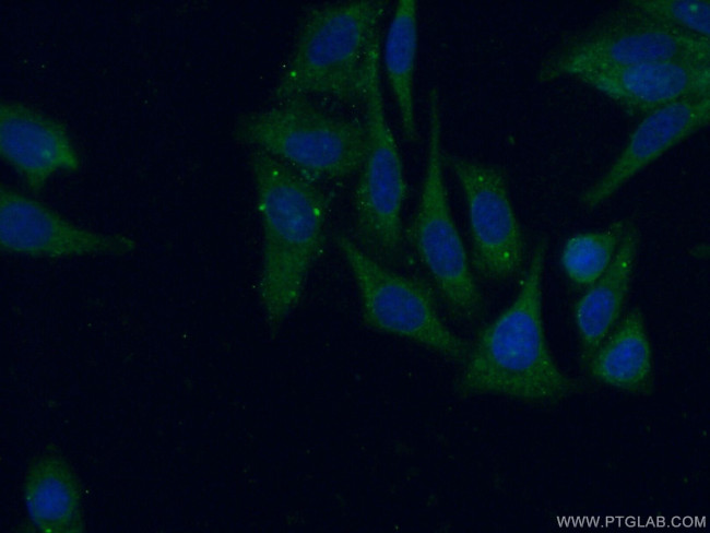 PIGT Antibody in Immunocytochemistry (ICC/IF)