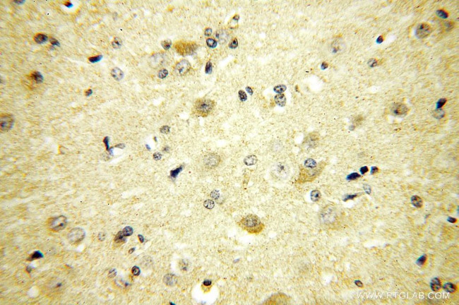 PIGT Antibody in Immunohistochemistry (Paraffin) (IHC (P))