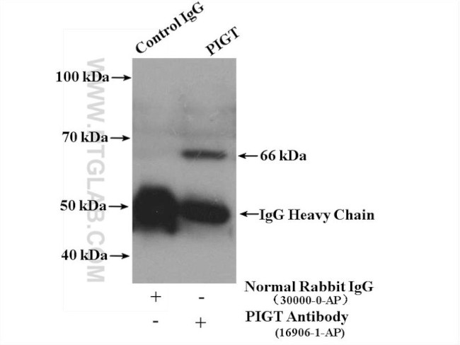 PIGT Antibody in Immunoprecipitation (IP)