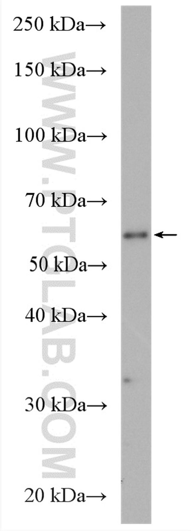 PIGT Antibody in Western Blot (WB)