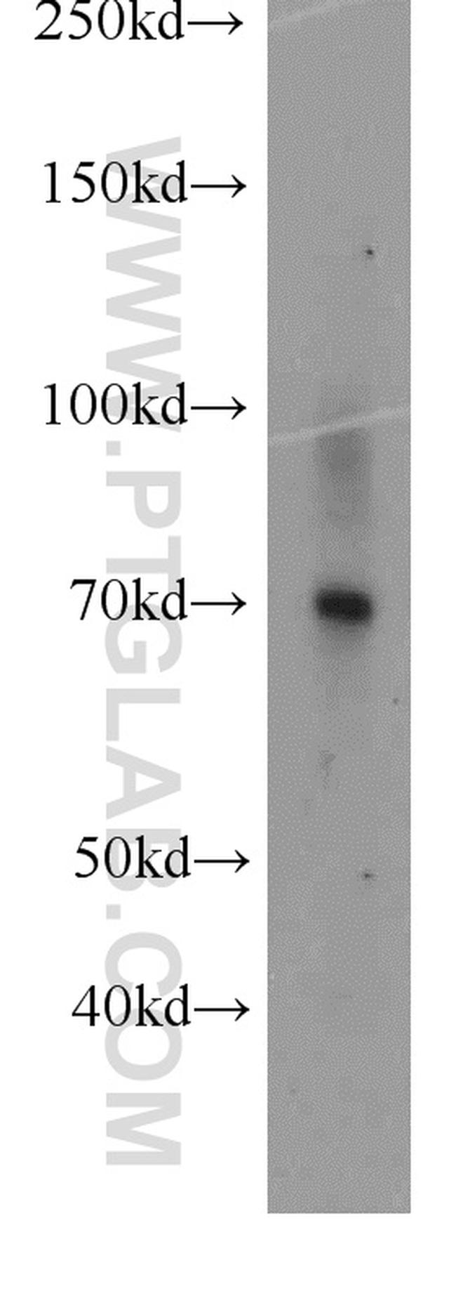 PROS1 Antibody in Western Blot (WB)