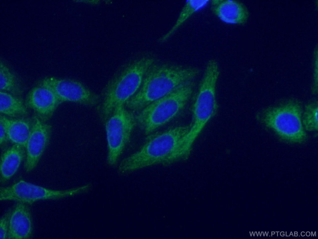 PROS1 Antibody in Immunocytochemistry (ICC/IF)