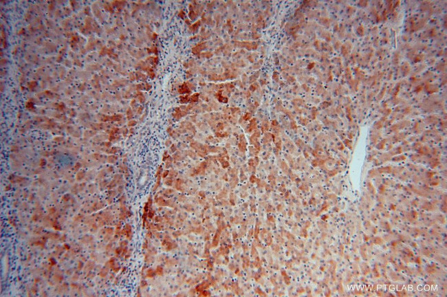 PROS1 Antibody in Immunohistochemistry (Paraffin) (IHC (P))