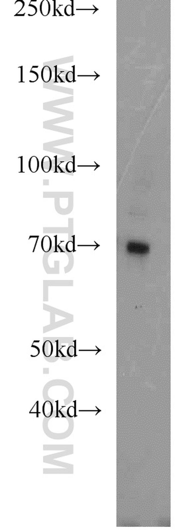 PROS1 Antibody in Western Blot (WB)