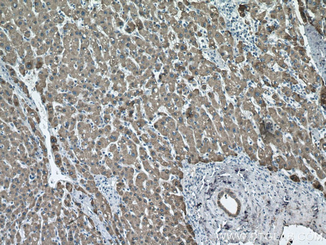 CES1 Antibody in Immunohistochemistry (Paraffin) (IHC (P))