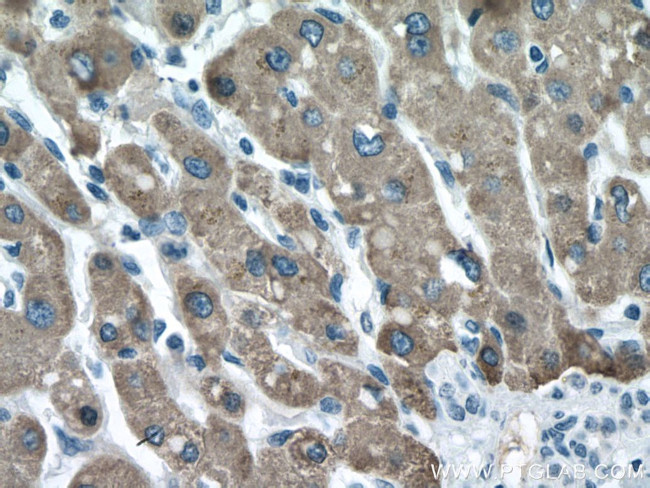 CES1 Antibody in Immunohistochemistry (Paraffin) (IHC (P))