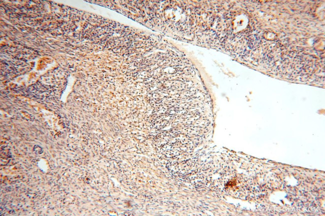 CES1 Antibody in Immunohistochemistry (Paraffin) (IHC (P))