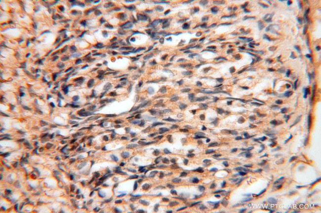 CES1 Antibody in Immunohistochemistry (Paraffin) (IHC (P))