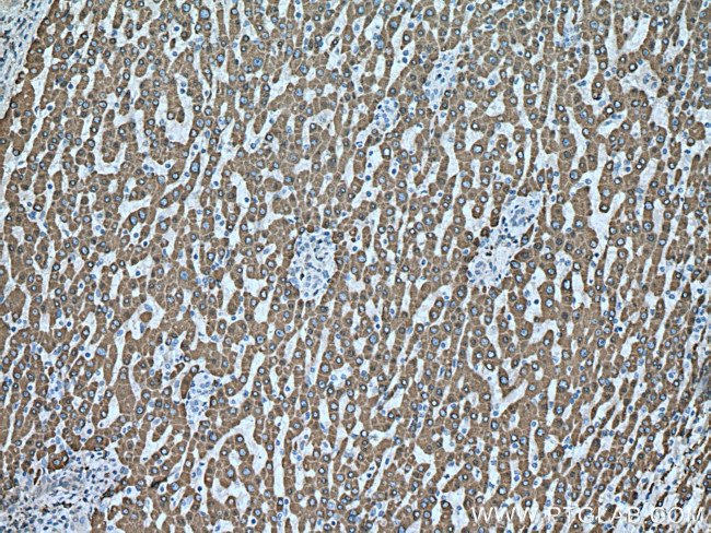 CES1 Antibody in Immunohistochemistry (Paraffin) (IHC (P))