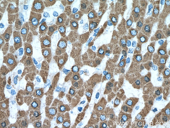 CES1 Antibody in Immunohistochemistry (Paraffin) (IHC (P))