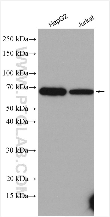 CES1 Antibody in Western Blot (WB)