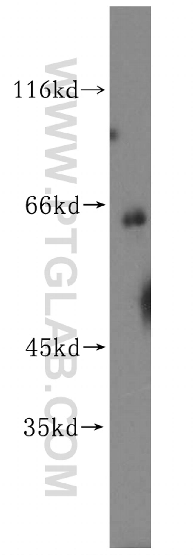 CES1 Antibody in Western Blot (WB)