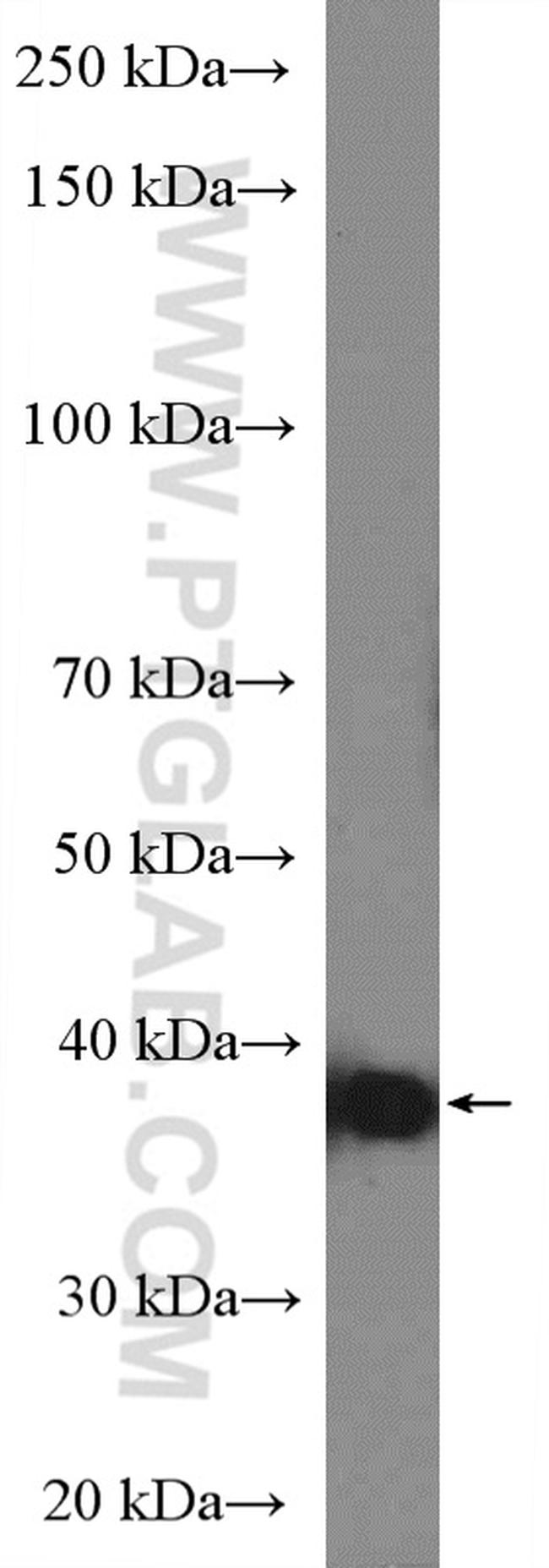 HLA-G Antibody in Western Blot (WB)