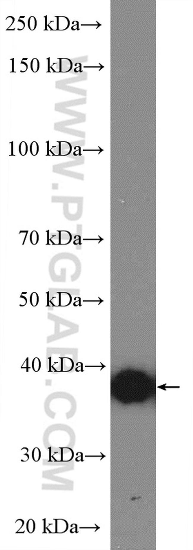 HLA-G Antibody in Western Blot (WB)