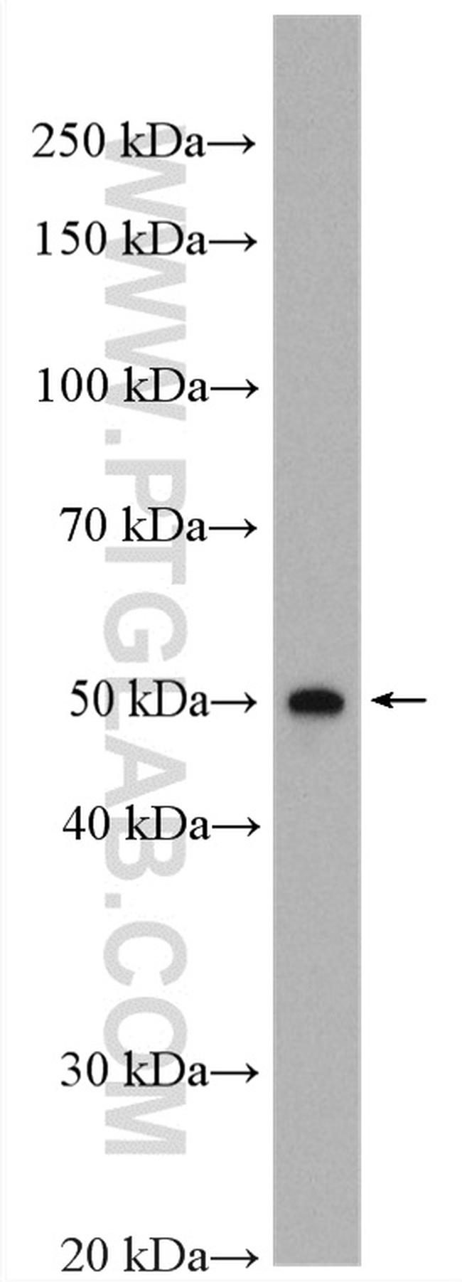 Kir6.2 Antibody in Western Blot (WB)