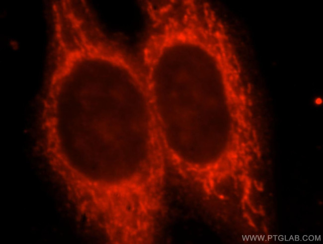 Kir6.2 Antibody in Immunocytochemistry (ICC/IF)