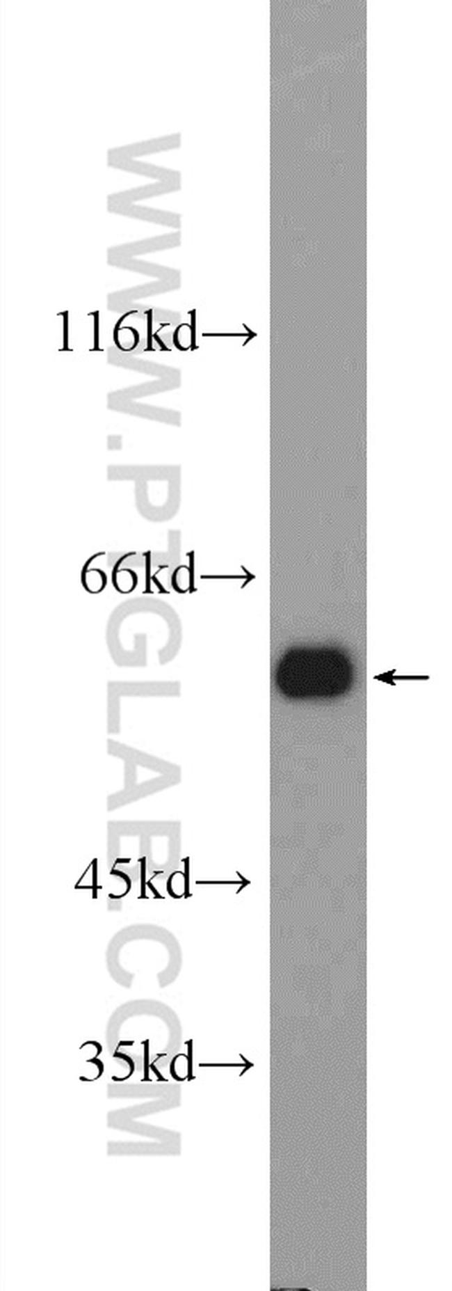 ATL3 Antibody in Western Blot (WB)