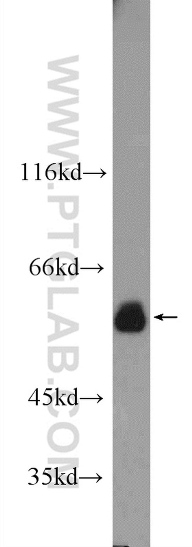 ATL3 Antibody in Western Blot (WB)