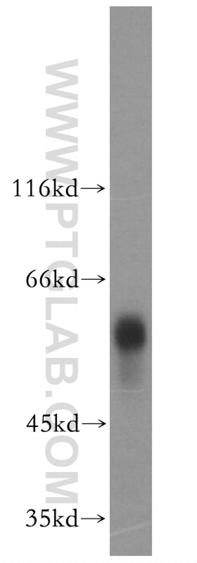 vitamin D binding protein Antibody in Western Blot (WB)