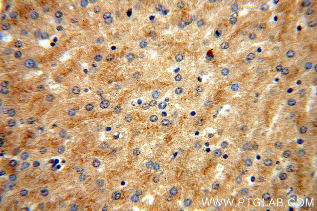 vitamin D binding protein Antibody in Immunohistochemistry (Paraffin) (IHC (P))