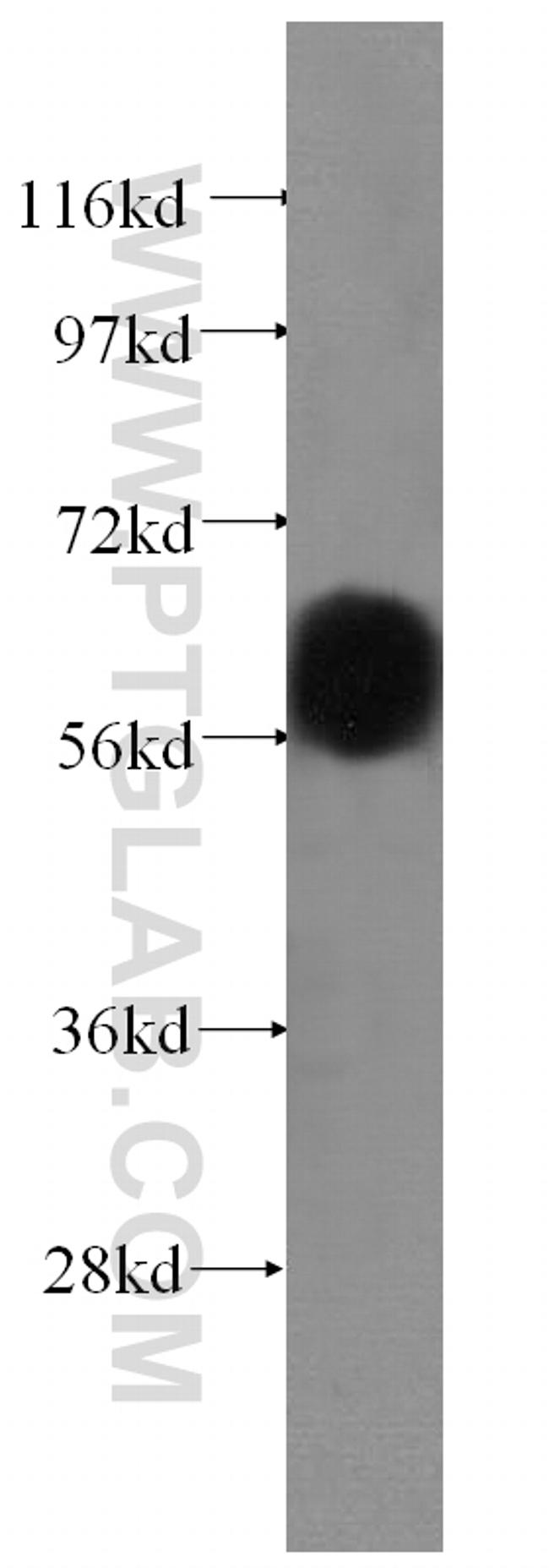 vitamin D binding protein Antibody in Western Blot (WB)