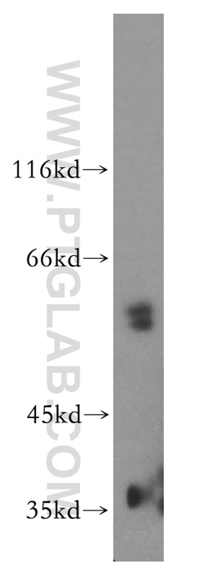 vitamin D binding protein Antibody in Western Blot (WB)