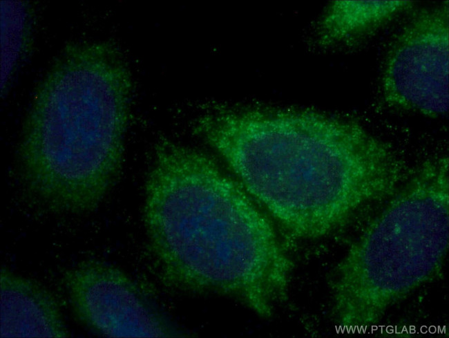 AP1B1 Antibody in Immunocytochemistry (ICC/IF)