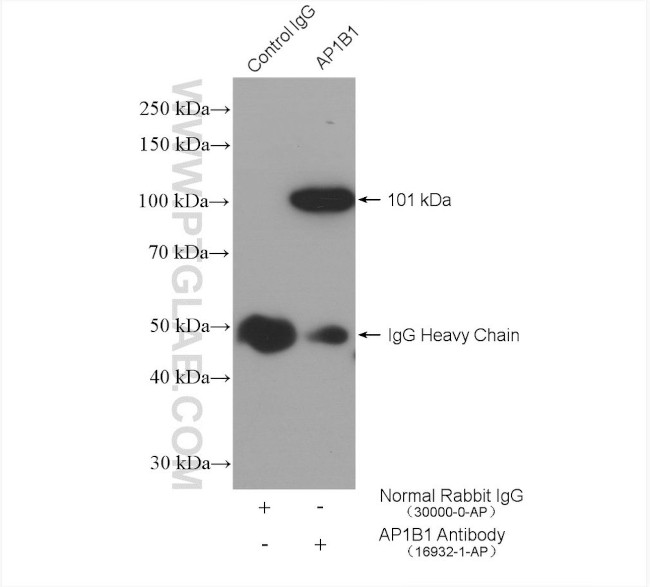 AP1B1 Antibody in Immunoprecipitation (IP)